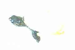 Hatchling-concentric_1893310175